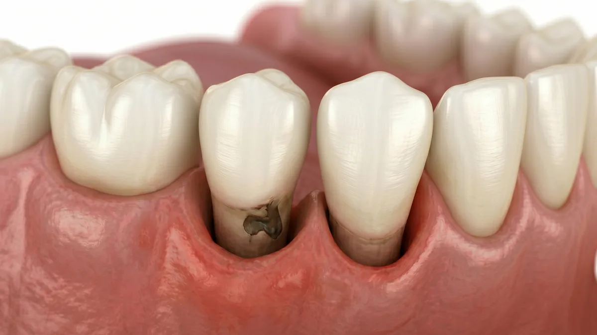 Bleeding Gums, Bad Breath or Loose Teeth: When to Seek Care