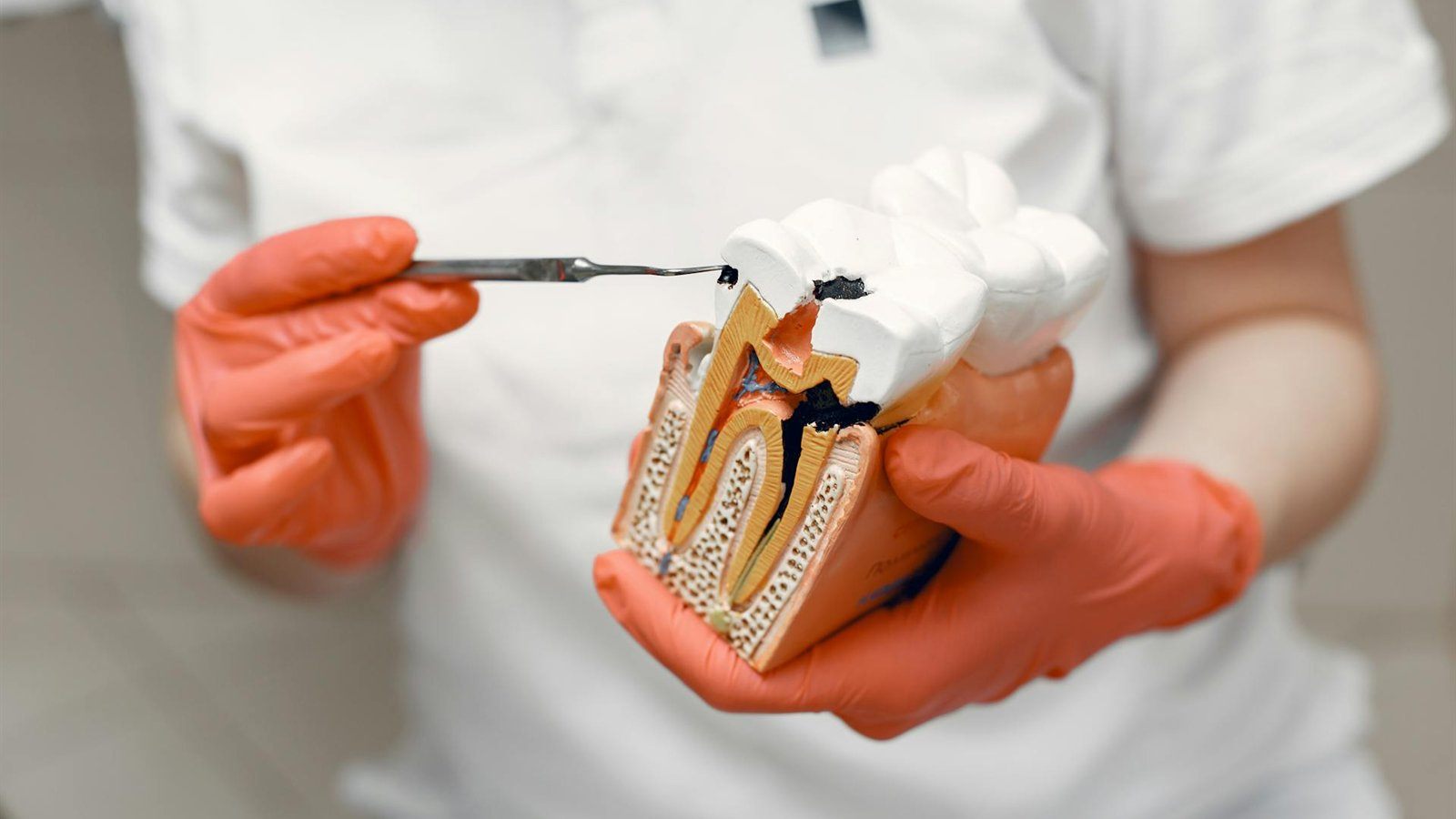 Getting a Root Canal in Gurugram? What to Expect Before Treatment