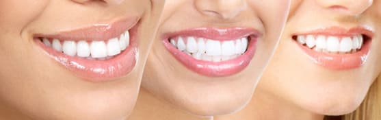 Cosmetic Dentist in Gurgaon