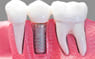 Dental clinic in Gurgaon