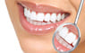 Smile makeover and cosmetic dentistry in Gurugram